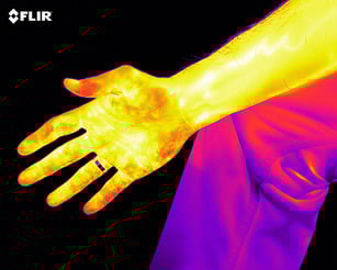 Arm And Veins-JPEG (Web - 72 dpi).jpg